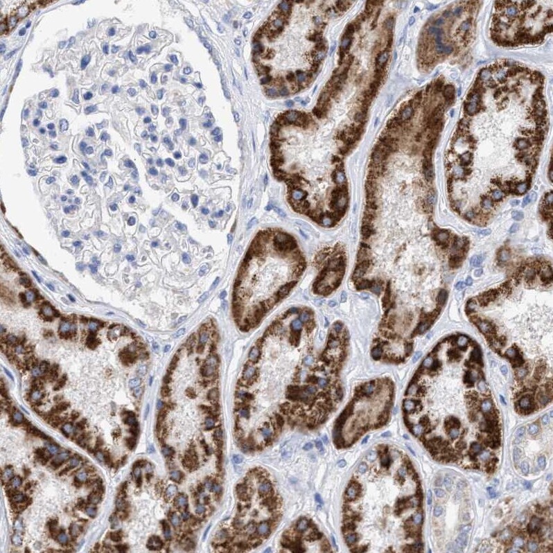 THEM2 Antibody - BSA Free Immunohistochemistry: THEM2 Antibody - BSA Free [NBP1-92498]