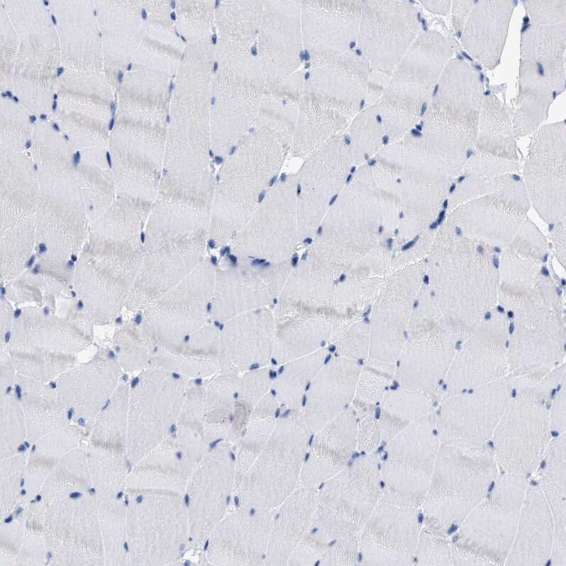 THEM2 Antibody - BSA Free Immunohistochemistry: THEM2 Antibody - BSA Free [NBP1-92498]