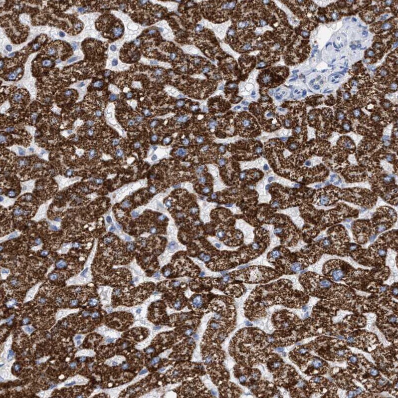 THEM2 Antibody - BSA Free Immunohistochemistry: THEM2 Antibody - BSA Free [NBP1-92498]
