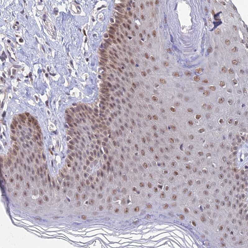 THOC3 Antibody - BSA Free Immunohistochemistry: THOC3 Antibody - BSA Free [NBP1-92502]