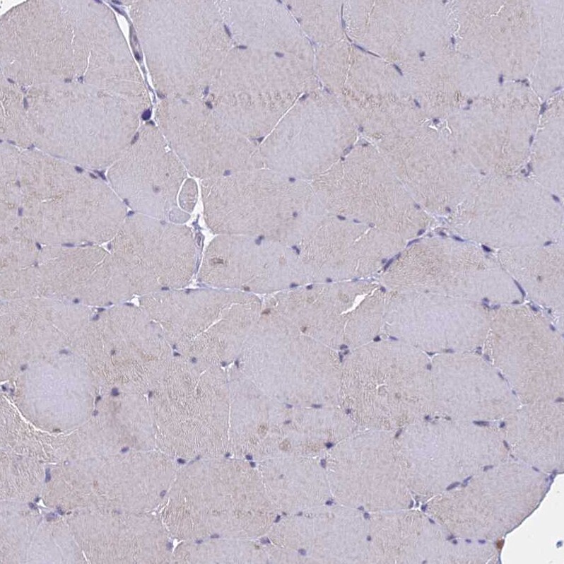 THOC3 Antibody - BSA Free Immunohistochemistry: THOC3 Antibody - BSA Free [NBP1-92502]