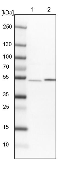 THUMPD2 Antibody - BSA Free Western Blot: THUMPD2 Antibody - BSA Free [NBP1-92504]