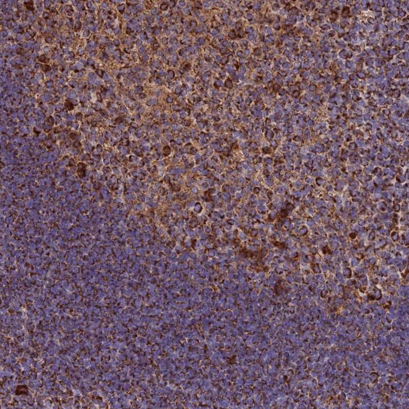 THUMPD2 Antibody - BSA Free Immunohistochemistry: THUMPD2 Antibody - BSA Free [NBP1-92504]
