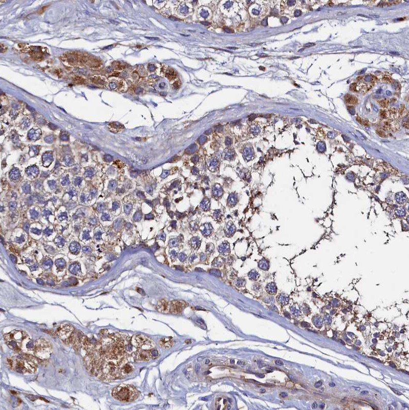 Thymidine Kinase 2 Antibody - BSA Free Immunohistochemistry-Paraffin: Thymidine Kinase 2 Antibody [NBP1-92505]