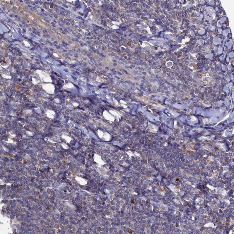 Thymidine Kinase 2 Antibody - BSA Free Immunohistochemistry-Paraffin: Thymidine Kinase 2 Antibody [NBP1-92505]
