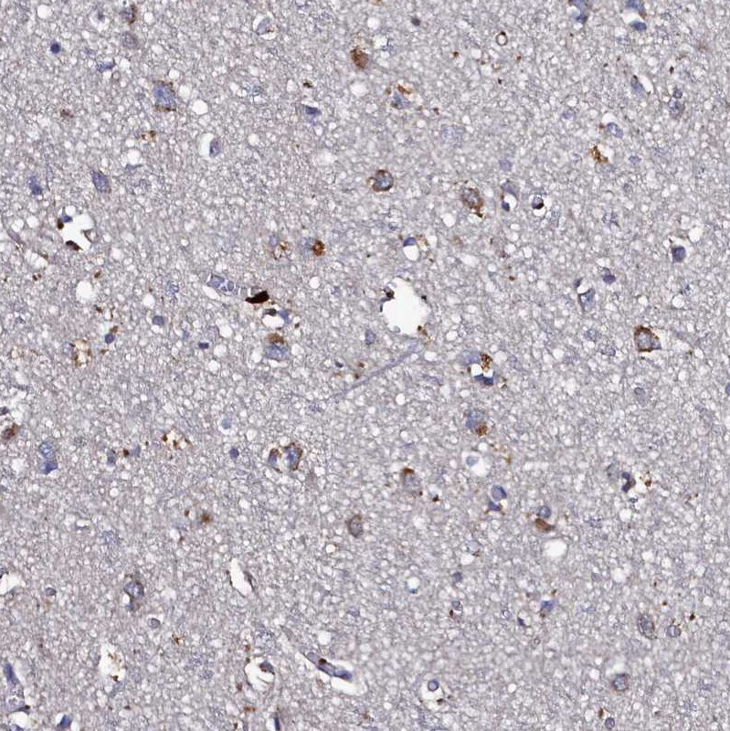 Thymidine Kinase 2 Antibody - BSA Free Immunohistochemistry-Paraffin: Thymidine Kinase 2 Antibody [NBP1-92505]
