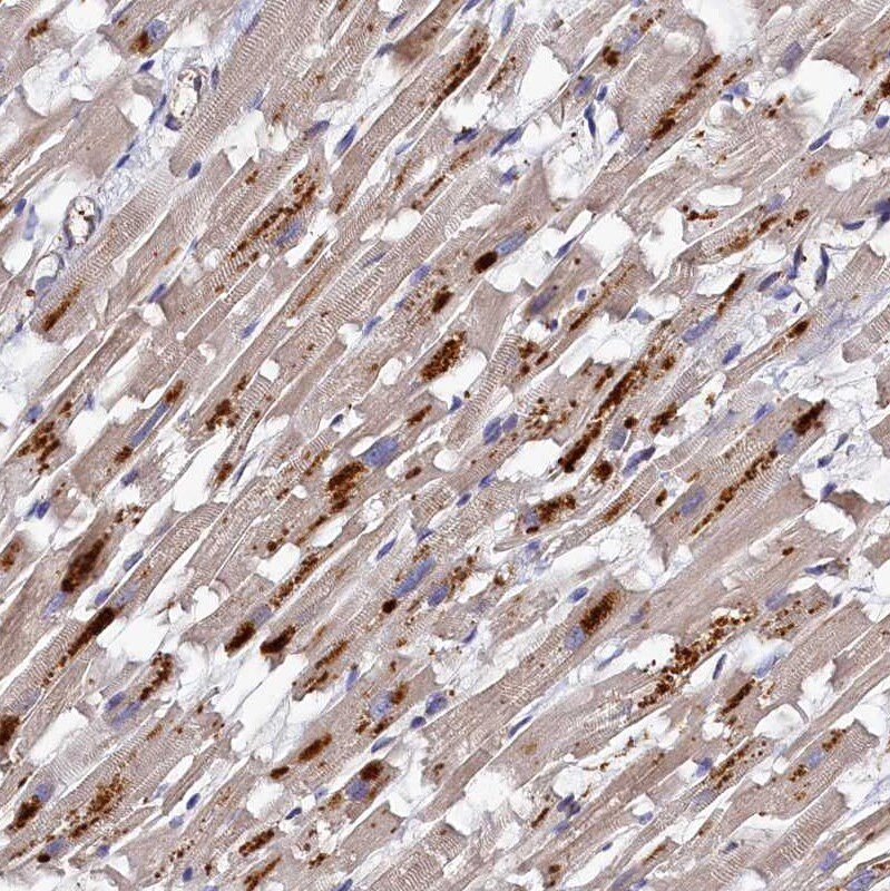 Thymidine Kinase 2 Antibody - BSA Free Immunohistochemistry-Paraffin: Thymidine Kinase 2 Antibody [NBP1-92505]
