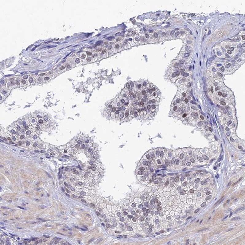 TIF1 alpha Antibody - BSA Free Immunohistochemistry: TIF1 alpha Antibody - BSA Free [NBP1-92506]