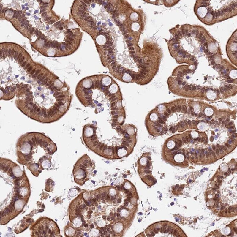 TMEM104 Antibody - BSA Free Immunohistochemistry: TMEM104 Antibody - BSA Free [NBP1-92515]