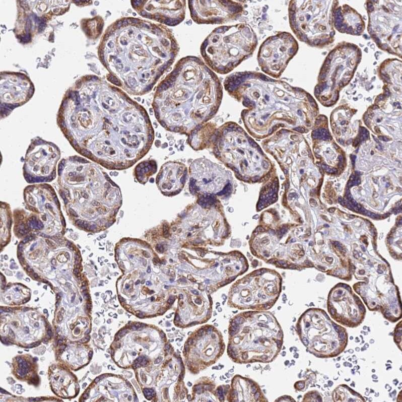 TMEM104 Antibody - BSA Free Immunohistochemistry: TMEM104 Antibody - BSA Free [NBP1-92515]