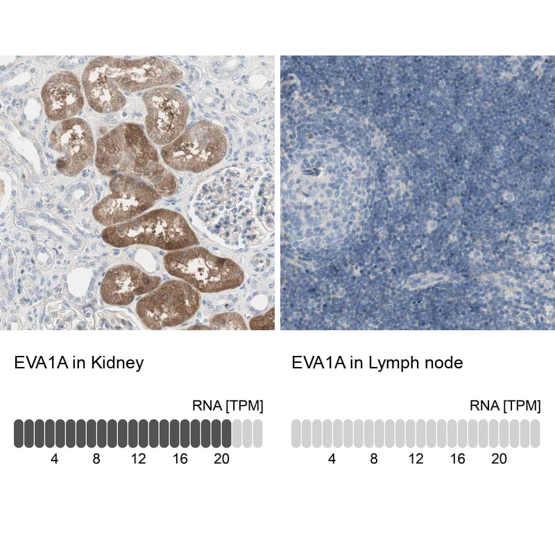 TMEM166 Antibody - BSA Free Immunohistochemistry: TMEM166 Antibody - BSA Free [NBP1-92517]