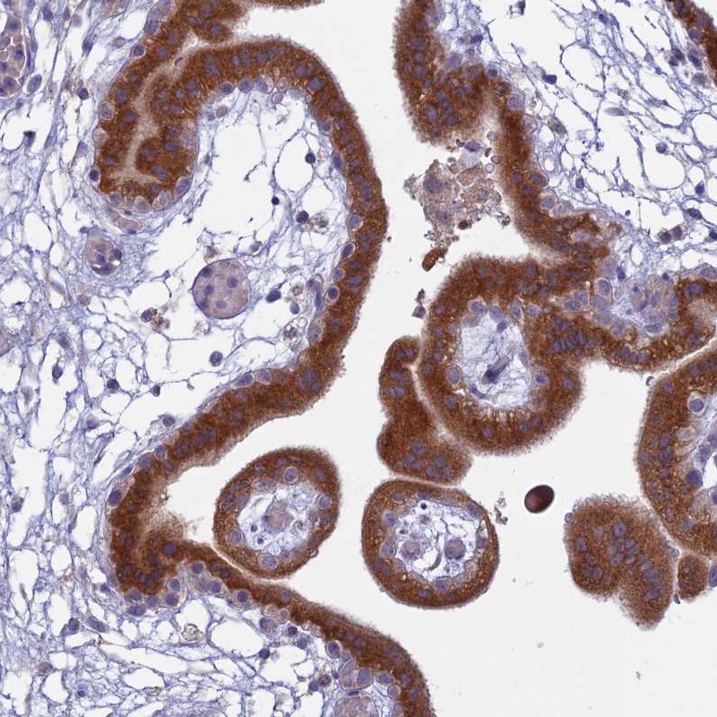 TMEM208 Antibody - BSA Free Immunohistochemistry: TMEM208 Antibody - BSA Free [NBP1-92518]