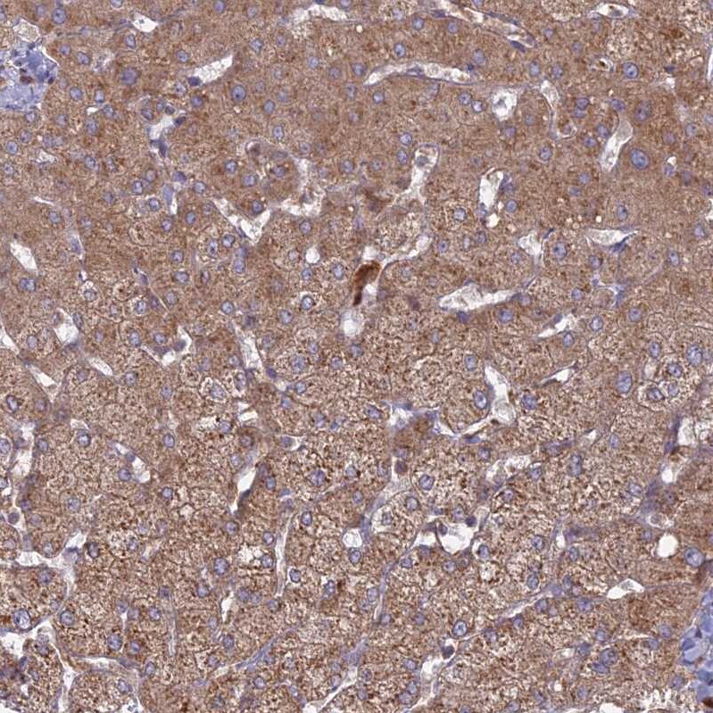 TMEM208 Antibody - BSA Free Immunohistochemistry: TMEM208 Antibody - BSA Free [NBP1-92519]