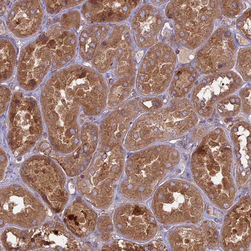 TMEM208 Antibody - BSA Free Immunohistochemistry: TMEM208 Antibody - BSA Free [NBP1-92519]