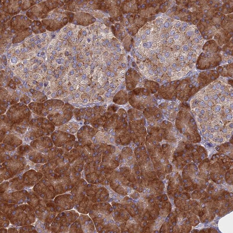 TMEM208 Antibody - BSA Free Immunohistochemistry: TMEM208 Antibody - BSA Free [NBP1-92519]