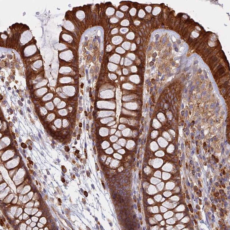 TMEM208 Antibody - BSA Free Immunohistochemistry: TMEM208 Antibody - BSA Free [NBP1-92519]