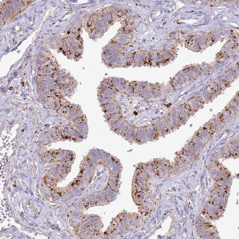 TMEM229B Antibody - BSA Free Immunohistochemistry: TMEM229B Antibody - BSA Free [NBP1-92520]