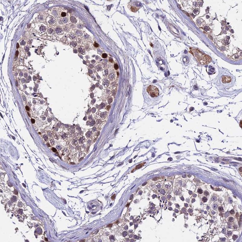 TRIML2 Antibody - BSA Free Immunohistochemistry: TRIML2 Antibody - BSA Free [NBP1-92531]