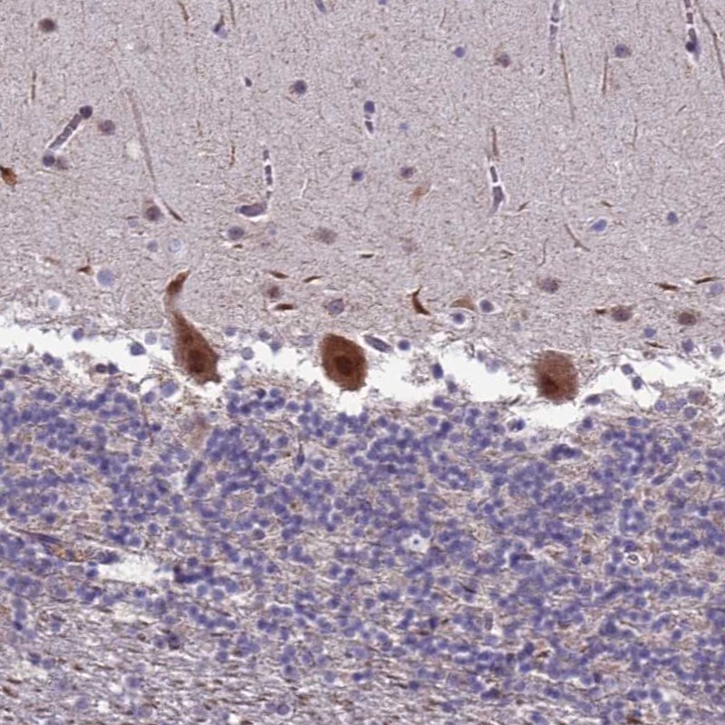 TROAP Antibody - BSA Free Immunohistochemistry: TROAP Antibody - BSA Free [NBP1-92532]