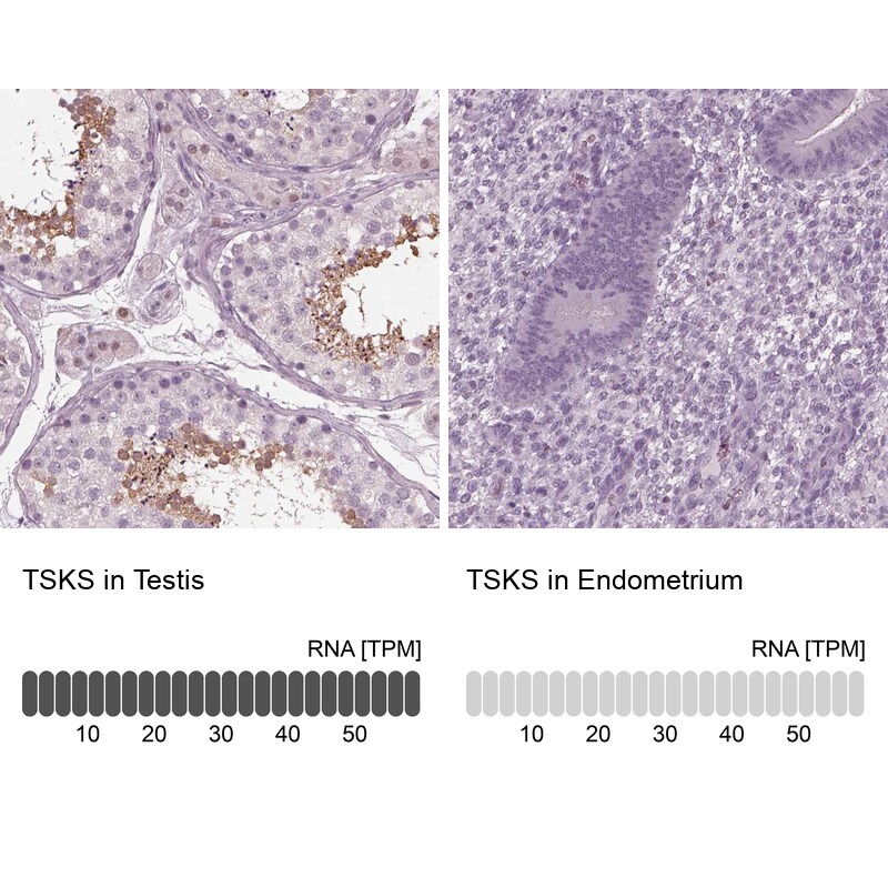 TSKS Antibody - BSA Free Immunohistochemistry: TSKS Antibody - BSA Free [NBP1-92539]