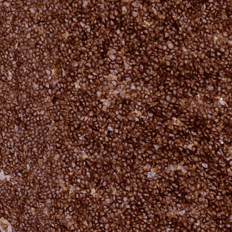 TTPAL Antibody - BSA Free Immunohistochemistry: TTPAL Antibody - BSA Free [NBP1-92544]
