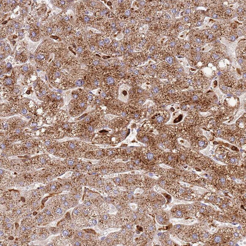 TTPAL Antibody - BSA Free Immunohistochemistry: TTPAL Antibody - BSA Free [NBP1-92544]