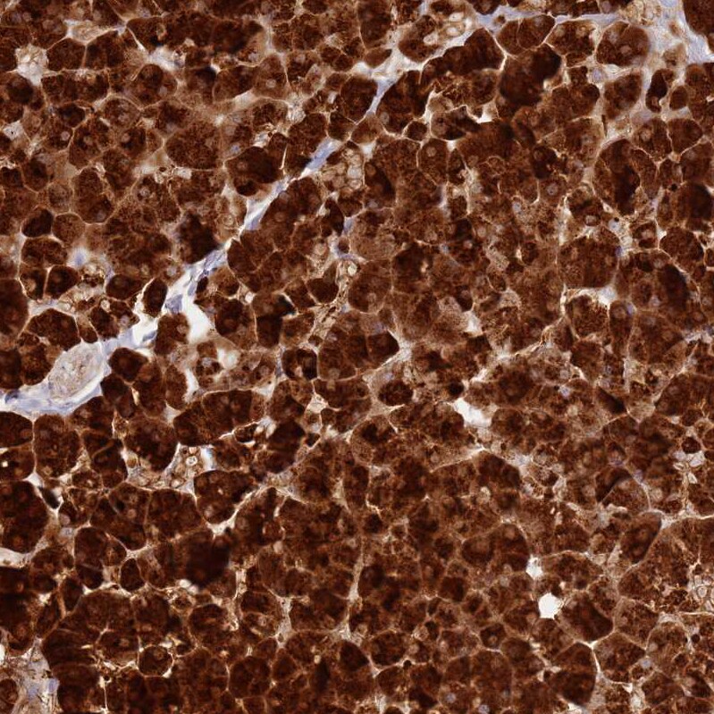 TTPAL Antibody - BSA Free Immunohistochemistry: TTPAL Antibody - BSA Free [NBP1-92544]