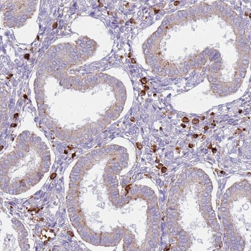 TTPAL Antibody - BSA Free Immunohistochemistry: TTPAL Antibody - BSA Free [NBP1-92544]