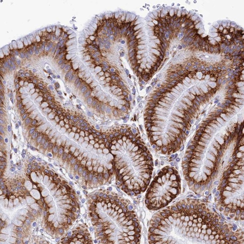 TUBGCP6 Antibody - BSA Free Immunohistochemistry: TUBGCP6 Antibody - BSA Free [NBP1-92548]