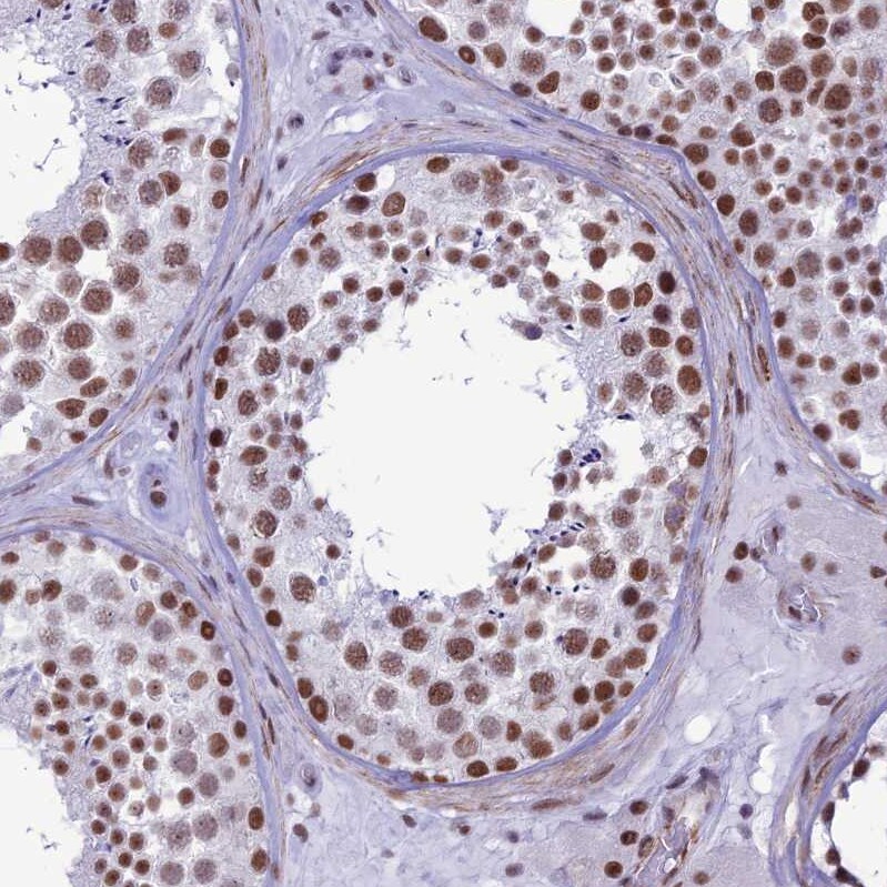U2AF35 Antibody - BSA Free Immunohistochemistry: U2AF35 Antibody - BSA Free [NBP1-92553]