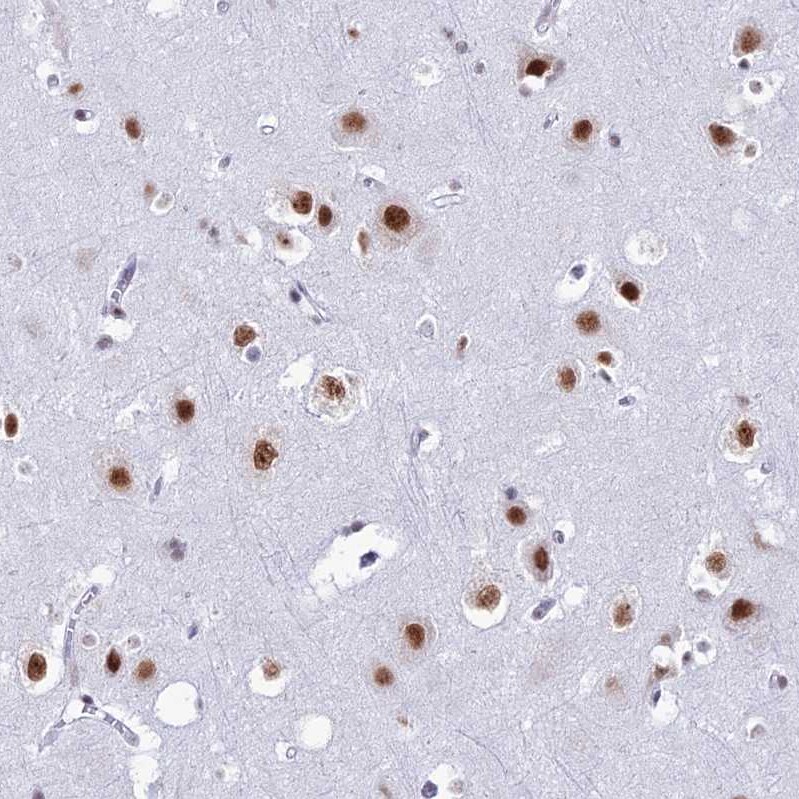 U2AF35 Antibody - BSA Free Immunohistochemistry: U2AF35 Antibody - BSA Free [NBP1-92553]