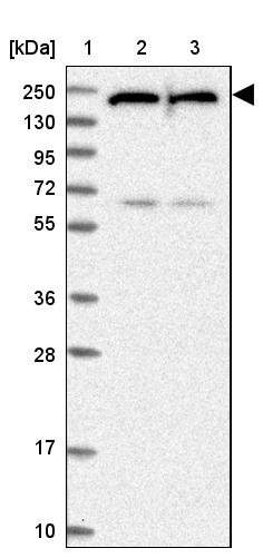 UACA Antibody - BSA Free Western Blot: UACA Antibody - BSA Free [NBP1-92554]