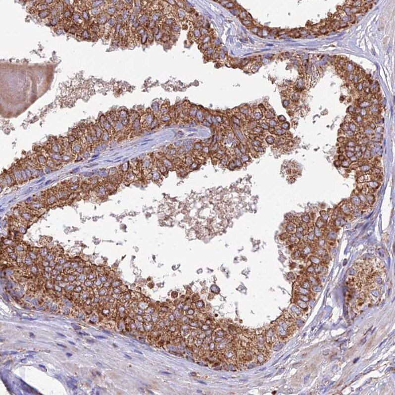 UAP1L1 Antibody - BSA Free Immunohistochemistry: UAP1L1 Antibody - BSA Free [NBP1-92555]