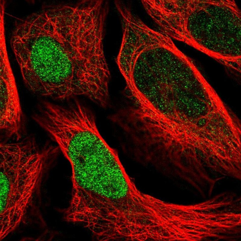 UBE2E2 Antibody - BSA Free Immunocytochemistry/ Immunofluorescence: UBE2E2 Antibody - BSA Free [NBP1-92556]