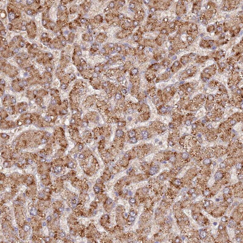 UQCRQ Antibody - BSA Free Immunohistochemistry: UQCRQ Antibody - BSA Free [NBP1-92563]