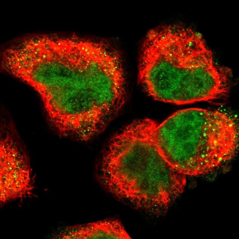 Uroplakin IIIB Antibody - BSA Free Immunocytochemistry/ Immunofluorescence: Uroplakin IIIB Antibody [NBP1-92564]