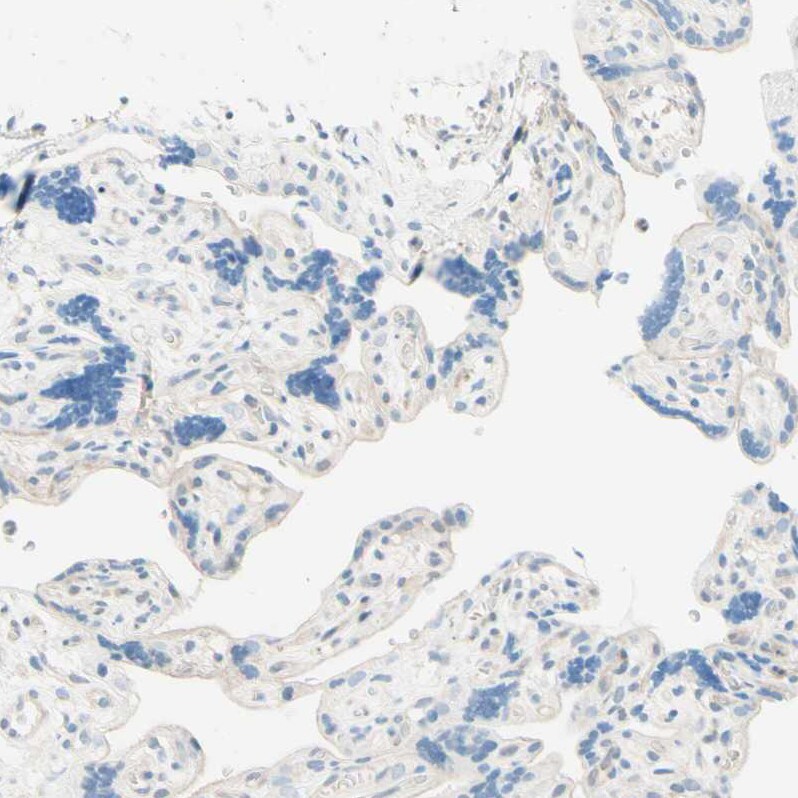 Uroplakin IIIB Antibody - BSA Free Immunohistochemistry: Uroplakin IIIB Antibody - BSA Free [NBP1-92564]