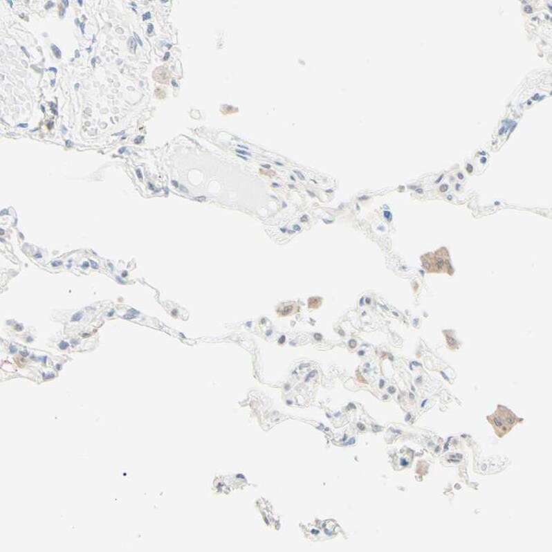 Uroplakin IIIB Antibody - BSA Free Immunohistochemistry: Uroplakin IIIB Antibody - BSA Free [NBP1-92564]