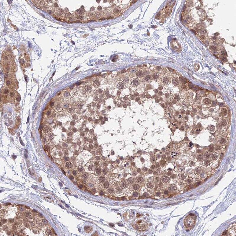 UROS Antibody - BSA Free Immunohistochemistry: UROS Antibody - BSA Free [NBP1-92565]