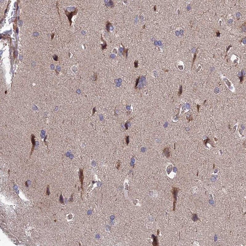 UROS Antibody - BSA Free Immunohistochemistry: UROS Antibody - BSA Free [NBP1-92565]
