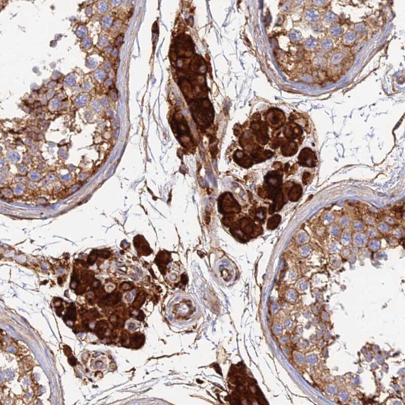 VAT1 Antibody - BSA Free Immunohistochemistry: VAT1 Antibody - BSA Free [NBP1-92569]