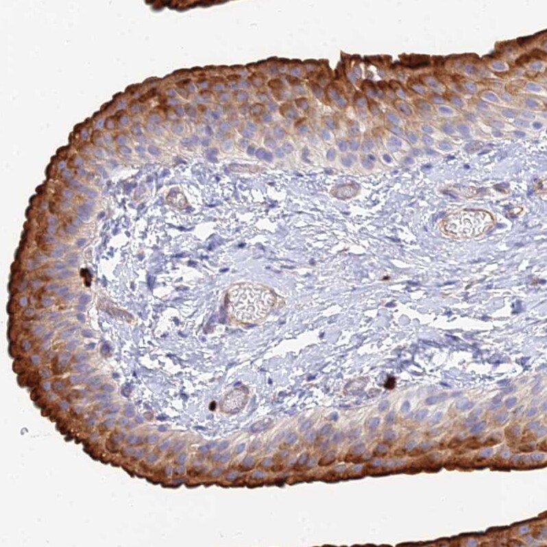 VAT1 Antibody - BSA Free Immunohistochemistry: VAT1 Antibody - BSA Free [NBP1-92569]