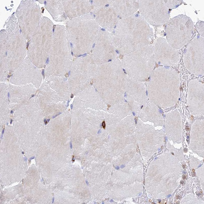 VAT1 Antibody - BSA Free Immunohistochemistry: VAT1 Antibody - BSA Free [NBP1-92569]