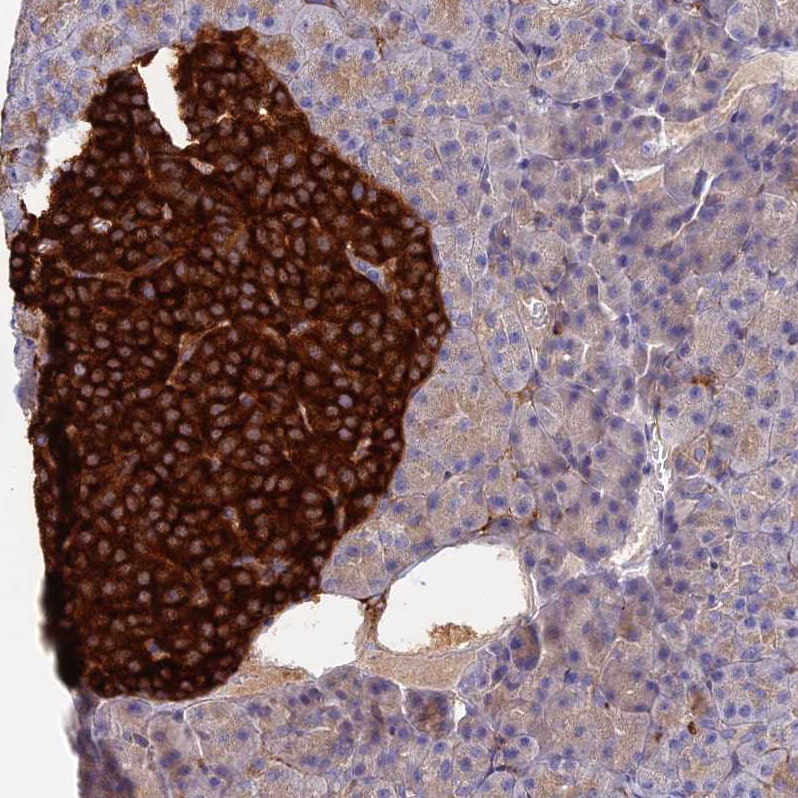 VAT1 Antibody - BSA Free Immunohistochemistry: VAT1 Antibody - BSA Free [NBP1-92569]