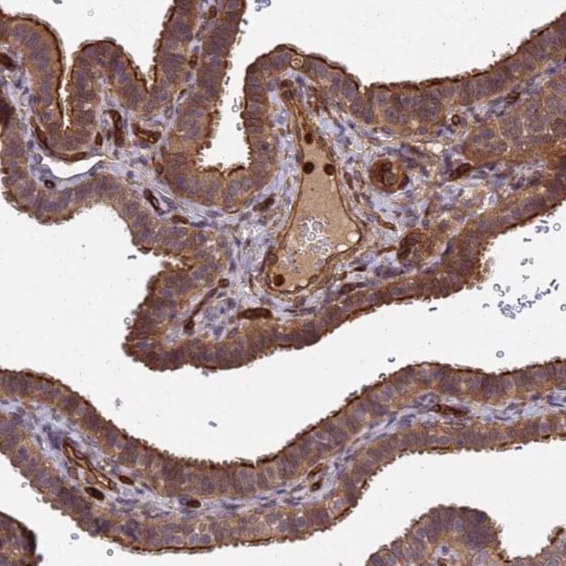 VEST1 Antibody - BSA Free Immunohistochemistry: VEST1 Antibody - BSA Free [NBP1-92571]