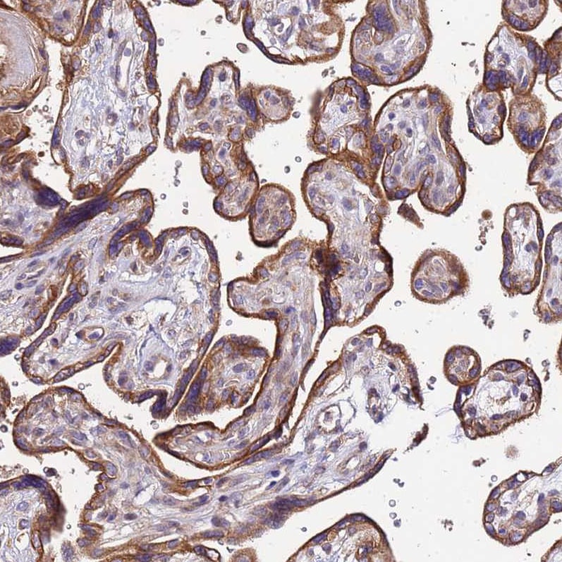 VMO1 Antibody - BSA Free Immunohistochemistry: VMO1 Antibody - BSA Free [NBP1-92574]