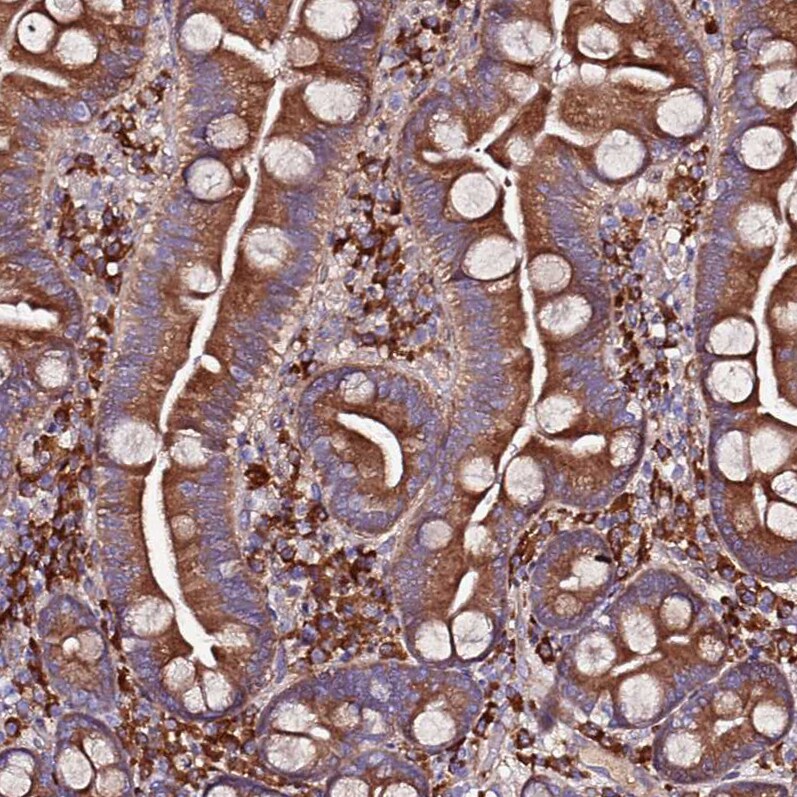 VMO1 Antibody - BSA Free Immunohistochemistry: VMO1 Antibody - BSA Free [NBP1-92574]