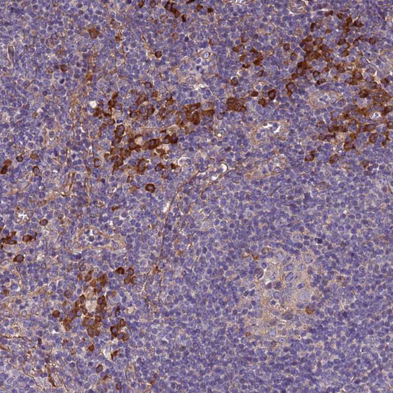 VMO1 Antibody - BSA Free Immunohistochemistry: VMO1 Antibody - BSA Free [NBP1-92574]