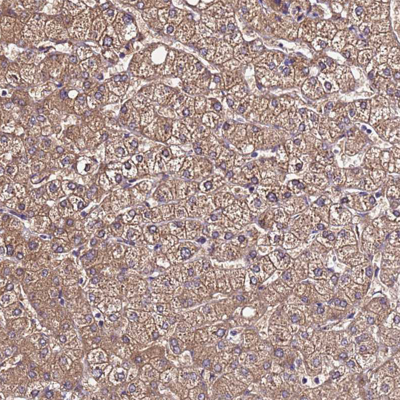 VMO1 Antibody - BSA Free Immunohistochemistry: VMO1 Antibody - BSA Free [NBP1-92574]