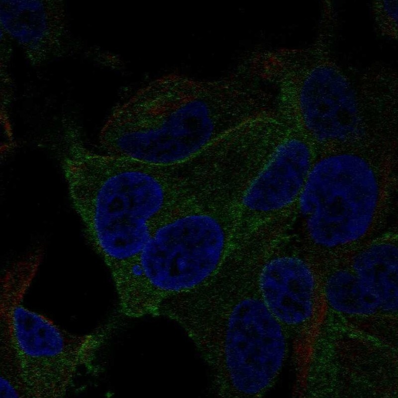 VRL1 Antibody - BSA Free Immunocytochemistry/ Immunofluorescence: VRL1 Antibody - BSA Free [NBP1-92576]